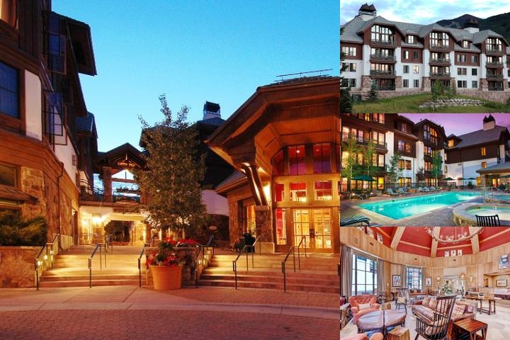 The Residences at Mountain Lodge photo collage