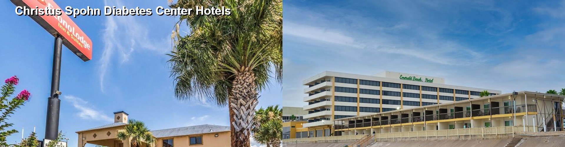 3 Best Hotels near Christus Spohn Diabetes Center