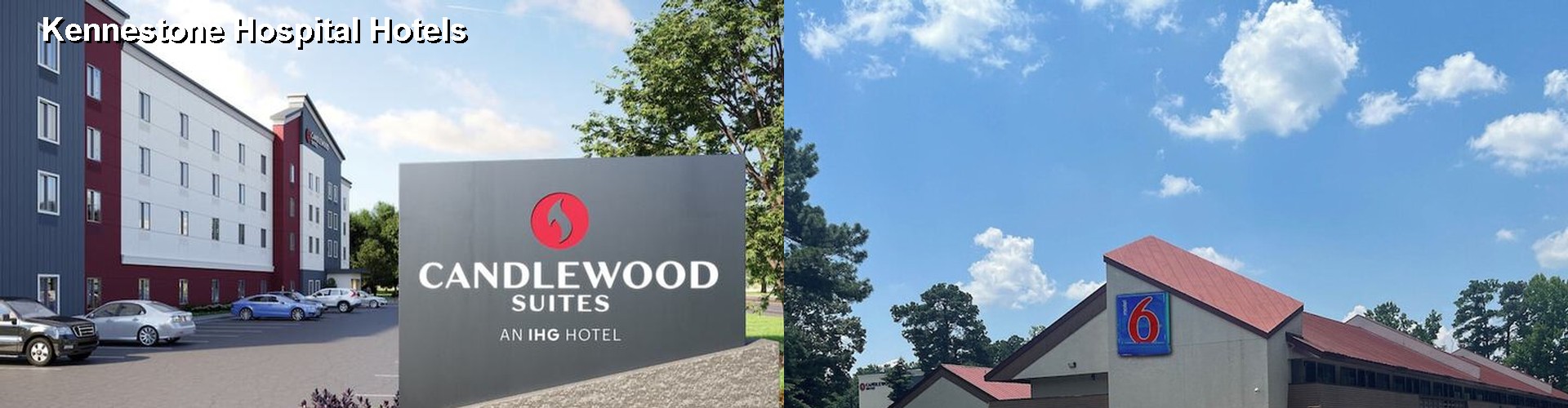 2 Best Hotels near Kennestone Hospital