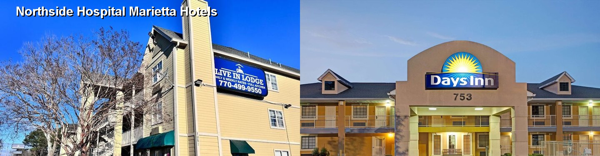 3 Best Hotels near Northside Hospital Marietta